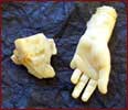 Die abgel�ste Hand mit einem Teil der Manschette